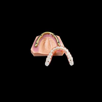 Đường cầu Zirconia nha khoa tùy chỉnh trên thanh cấy ghép nghiền chính xác cao