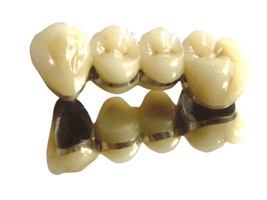 Mua Màu răng Cobalt Chromium Crown PFM cao quý răng PFM online manufacture