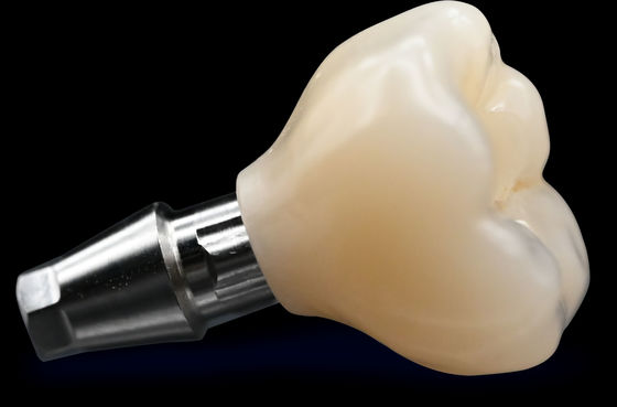 Mua CAD / CAM Cấy ghép Vương miện cầu thẩm mỹ cao Vương miện Zirconia online manufacture