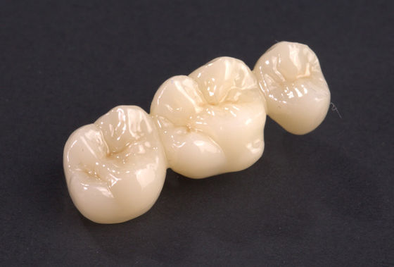 Mua Chọn chính xác Full Contour Zirconia Bridge Natural Zirconia Crown Bridge Độ bền cao online manufacture