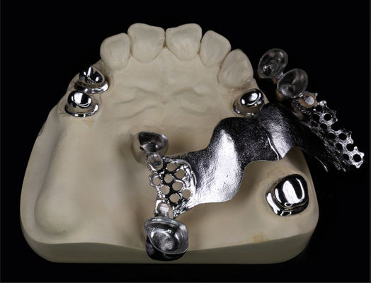 Mua Kính thiên văn răng nhân tạo có thể tháo rời với kết thúc răng giả kết hợp và khung kim loại online manufacture
