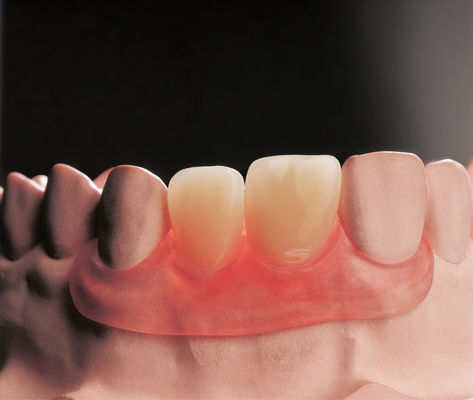 Mua Flexible Flipper Removable Dentures Clinical Removable Partial Prosthodontics Các loại răng giả có thể lấy được online manufacture