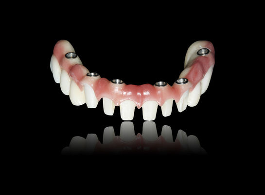 Mua Tất cả trên X Cấy ghép Zirconia Bridge Cấy ghép Crown Bridge Nhìn tự nhiên online manufacture