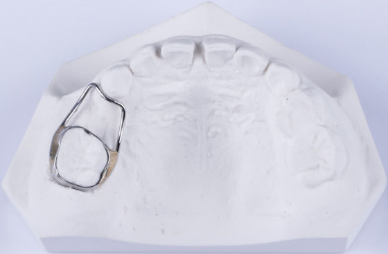 Mua Bộ giữ không gian răng có thể tùy chỉnh cho bộ giữ răng để sửa khoảng cách online manufacture