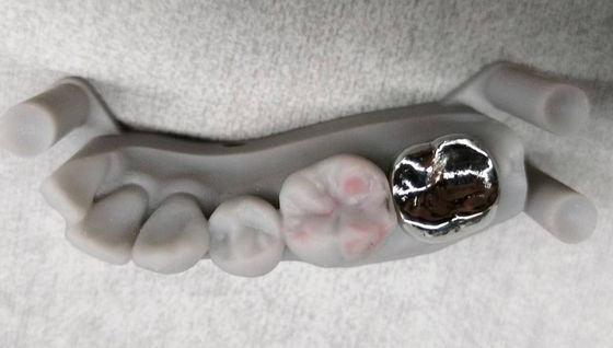Mua Full Metal Non Precious Crown Implant PFM Crown And Bridge chuyên nghiệp online manufacture