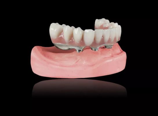 Mua Cấy ghép thanh titan răng giả có thể tháo rời Đồng hợp kim titan Cấy ghép thanh titan răng giả online manufacture
