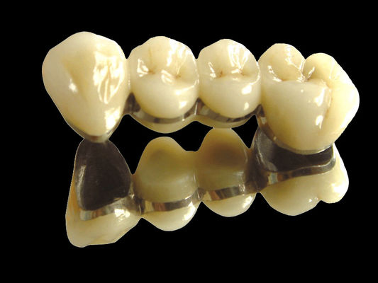 Mua Đường cầu kim loại quý cấy ghép cầu vương miện chống mòn tùy chỉnh online manufacture