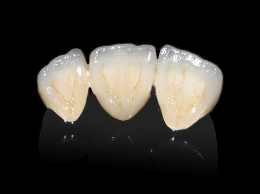 Mua Implant Dental PFM Bridge Non Precious CAD CAM PFM Crown online manufacture