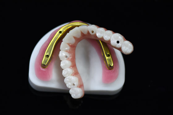 Mua Đường cầu Zirconia nha khoa tùy chỉnh trên thanh cấy ghép nghiền chính xác cao online manufacture