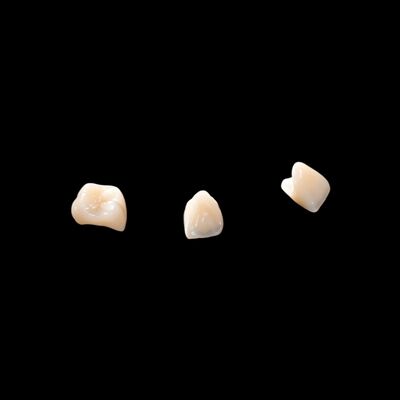 Mua CAD/CAM Porcelain hợp nhất với Zirconia Bridge để phục hồi vẻ ngoài tự nhiên online manufacture