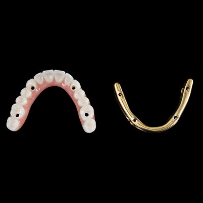 Mua Tùy chỉnh cấy ghép răng lai răng giả lai với thanh titanium online manufacture