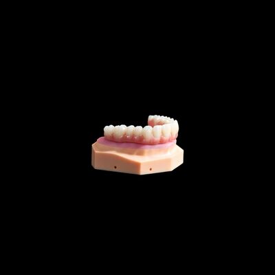 Mua Tất cả trên X cấy ghép Titanium cầu nha khoa với tổng hợp chính xác online manufacture