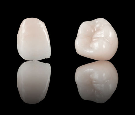 Phong cách thẩm mỹ cao toàn diện vương miện răng Zirconia Bridge CE và FDA chấp thuận