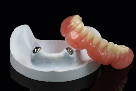 Xử lý răng giả có thể tháo rời bằng kính thiên văn