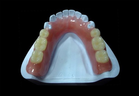 Mẫu răng giả acrylic bán phần có thể tháo rời màu hồng Mẫu răng giả acrylic tạm thời