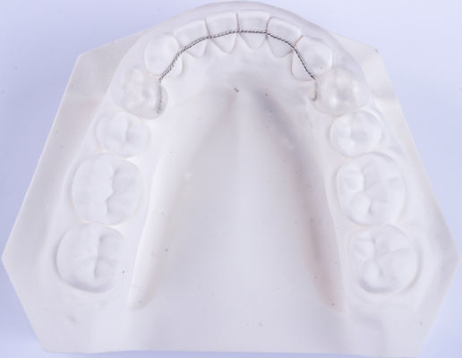 Không tháo rời Lưỡi dây giữ Orthodontics giữ để thẳng răng