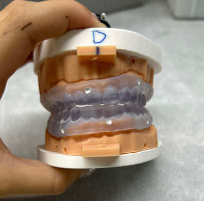 Các răng giả in 3D có thể tùy chỉnh thử trong răng giả hoàn chỉnh kỹ thuật số