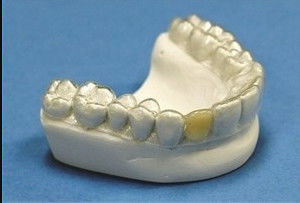 răng ổn định răng chỉnh nha giữ chuyên nghiệp giữ rõ ràng