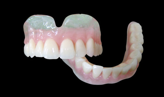 Vertex Clear Partial Overdenture Phần răng giả có thể tháo rời