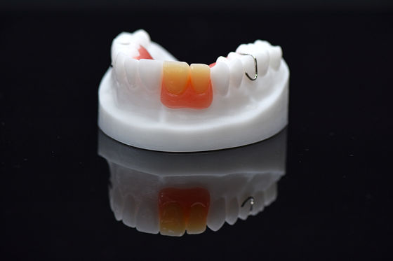 Acrylic Flipper Removable Overdenture Customized Removable Acrylic Denture (Bộ răng giả Acrylic có thể tháo rời)
