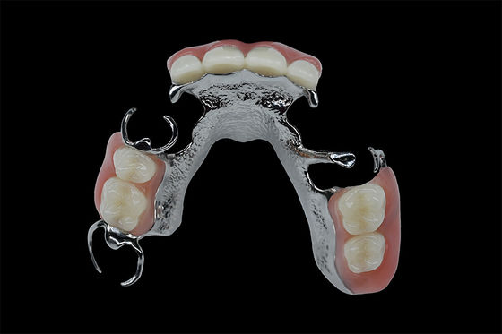Đơn vị hóa răng giả có thể tháo rời khung titan khung kim loại răng