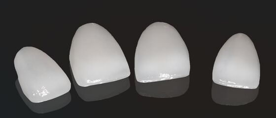 High Esthetics Composite Crown Onlay Veneer Kích thước tùy chỉnh